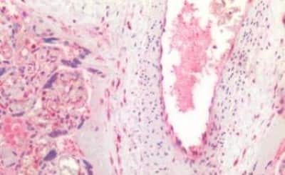 Immunohistochemistry-Paraffin: VEGF 165 Antibody [NBP3-14567] - Human Placenta: Formalin-Fixed, Paraffin-Embedded (FFPE)